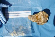 Überreste der Leiche von Maria B., die mit Branntkalk zersetzt wurde. Überreste der Leiche von Maria B., die mit Branntkalk zersetzt wurde.