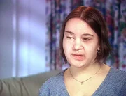 Vickis Gesicht ist für den Rest ihres Lebens entstellt. Als Kind wurde sie von einem Auto überfahren. Vickis Gesicht ist für den Rest ihres Lebens entstellt. Als Kind wurde sie von einem Auto überfahren.