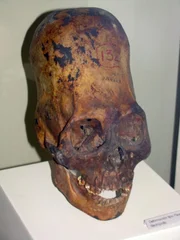 Alien Knochenstruktur im Schädel Alien Knochenstruktur im Schädel