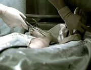 Gerichtsmediziner w&auml;hrend einer Autopsie (Foto)