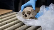 Ein echter menschlicher Sch&auml;del wurde auf einen Inspektionstisch gelegt, nachdem er in einer Lieferung in Philadelphia, Pa. entdeckt worden war (National Geographic)
