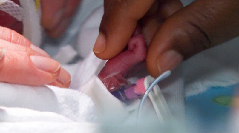 Kleines Leben - große Sorgen: Auf der Frühchenstation (D, 2025)