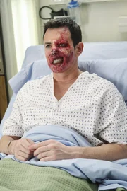 Eine gro&szlig;e, spektakul&auml;re Operation steht bevor: Dave Young (Larry Sullivan) soll ein neues Gesicht bekommen ...