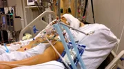 The young woman's brain has swelled severely as a result of the attack, and Dr. Navaz Karanjian tries to counteract the pressure in the skull with a catheter.