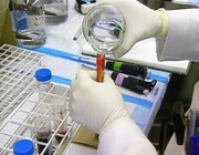 Mit der giftigen Substanz Excedrin reinigt man Aquarien. Hat Stella mit diesem Medikament versucht, die Lebensversicherung ihres Mannes zu kassieren?