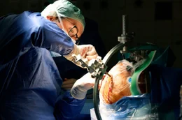 Gehirn-OP am Uniklinikum des Saarlandes in Homburg: Wie gut hilft die sog. Tiefe Hirnstimulation gegen die Symptome der Parkinson-Krankheit?