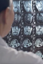 Das Bild zeigt einen Arzt, der medizinische R&ouml;ntgenbilder untersucht.