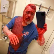 Mit einem Selfie dokumentierte Dmitry Muratow das auf ihn ver&uuml;bte Attentat mit acetonhaltiger &Ouml;lfarbe. W&auml;hrend einer Zugfahrt 2022 war er in seinem Schlafabteil attackiert worden.