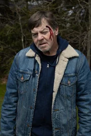 Ein Mann mit einer Kopfverletzung steht da.