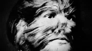 JoJo, der &bdquo;Junge mit dem Hundegesicht&ldquo; (1900)