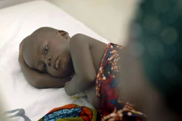 Mehr als 600.000 Menschen sterben j&auml;hrlich an Malaria &ndash; die meisten von ihnen sind Kinder.