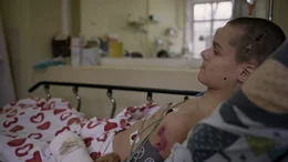 Als der 14-j&auml;hrige Wanja mit seiner Mutter aus dem besetzten Mariupol fl&uuml;chtete, wurde ihr Konvoi mit Raketen beschossen. Wanja wurde schwerstverletzt.