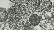 Das Nipah-Virus unter dem Mikroskop.