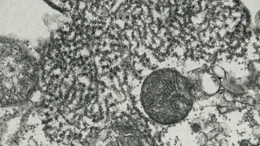 Das Nipah-Virus unter dem Mikroskop.