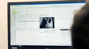 Tr&auml;umen unter Aufsicht: Im Schlafmedizinischen Zentrum der Berliner Charit&eacute; werden die Schlafzyklen und Vitalwerte der Patientinnen und Patienten durchgehend &uuml;berwacht.