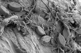 Plastikfund aus dem Westatlantik: Auf der Oberfl&auml;che siedeln Kieselalgen, Mikroben und Bakterien. Ein schleimiger Biofilm sch&uuml;tzt die Mikroorganismen, feine Chitin-F&auml;den geben Halt.