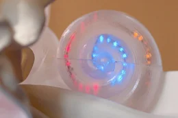 Das optogenetische Cochlea-Implantat-Modell versucht, die nicht mehr auf Schall reagierenden Nerven im Innenohr durch physikalische Lichtstimulanz zu aktivieren.