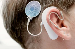 Durch die digitalen Lichtquellen des Cochlea-Implantats werden lichtempfindlich gemachte Synapsen in der H&ouml;rschnecke gereizt.