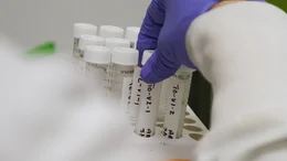 Gift im Blut: Die Bev&ouml;lkerung in der betroffenen Region im Nordwesten Georgias und in Teilen von Alabama weist weit &uuml;berdurchschnittliche Werte von PFAS im Blut auf.