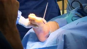 Due to a rare and dangerous disease, Jeffrey's feet have grown so huge that there are no more shoes for him to buy. Dr. Schaeffer is his last resort.