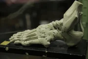 Picture Shows: Anatomical model of the foot.