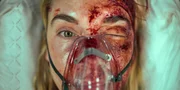 Die unbekannte Patientin (Kim Riedle) hat Schreckliches erlebt