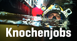 Knochenjobs